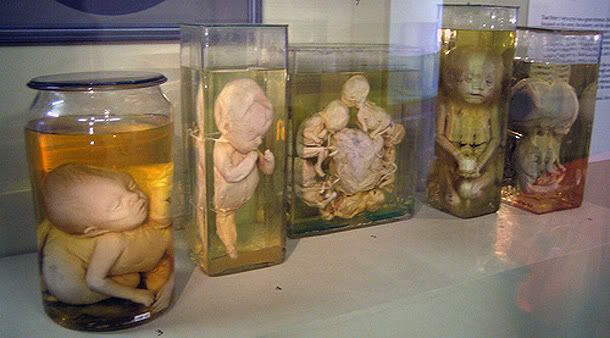 El Coleccionista de Fetos