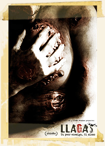 Llagas